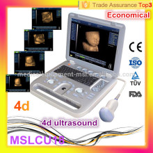 Beliebte Ultraschall! MSLCU18i Neueste billige portable 4D Ultraschall-Scanner / Laptop Ultraschall-Scanner